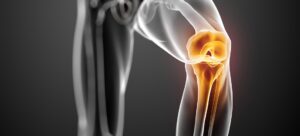 glucosamine musculation