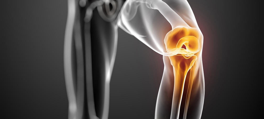 compléments pour articulations en musculation : flacon de compléments alimentaires avec haltères en arrière-plan