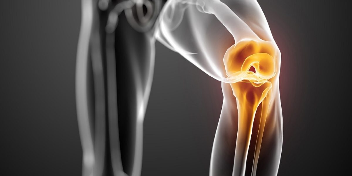 compléments pour articulations en musculation : flacon de compléments alimentaires avec haltères en arrière-plan